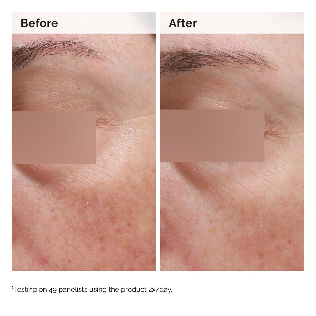 niacinamide-5-face-and-body-emulsion-y9 2024-08-23-ORD-Nia-5pct-Face-Body-B-A-Elasticity-Global-02-1x1.jpg