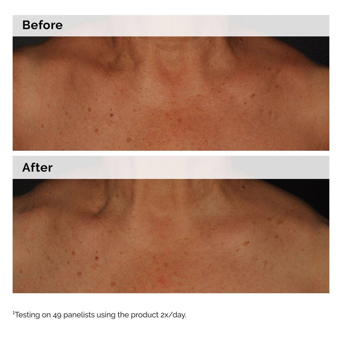 niacinamide-5-face-and-body-emulsion-y9 2024-08-23-ORD-Nia-5pct-Face-Body-B-A-Global-02-1x1.jpg