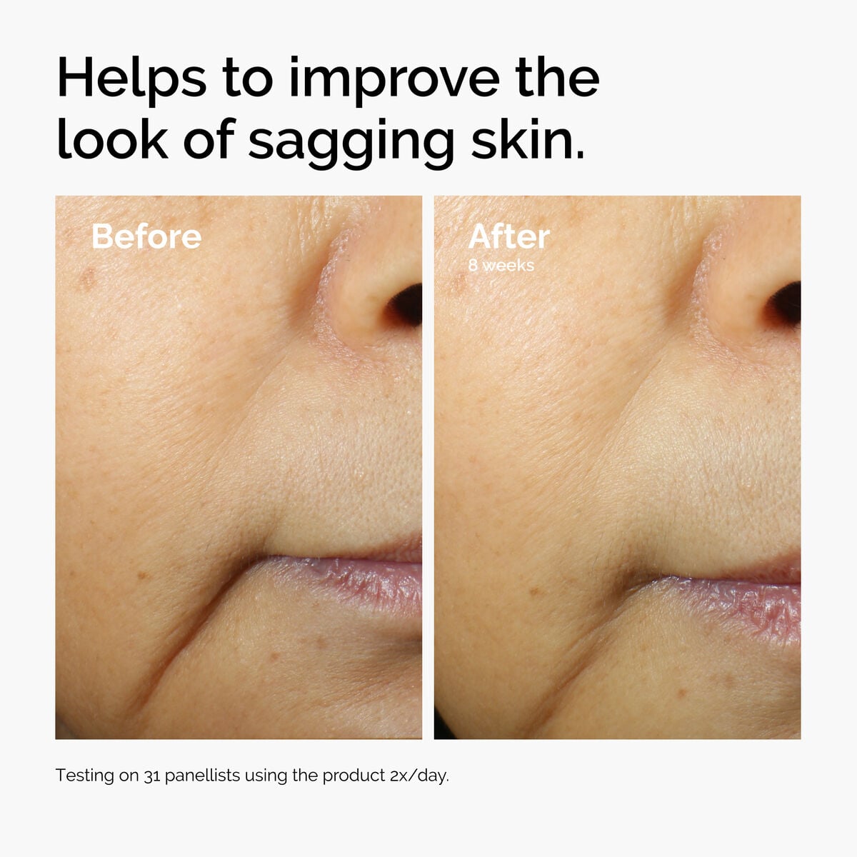 caffeine-3-escin-1-face-serum-k1 ord-caffeine-3pct-escin-1pct-face-serum-before-after-sagging.jpg