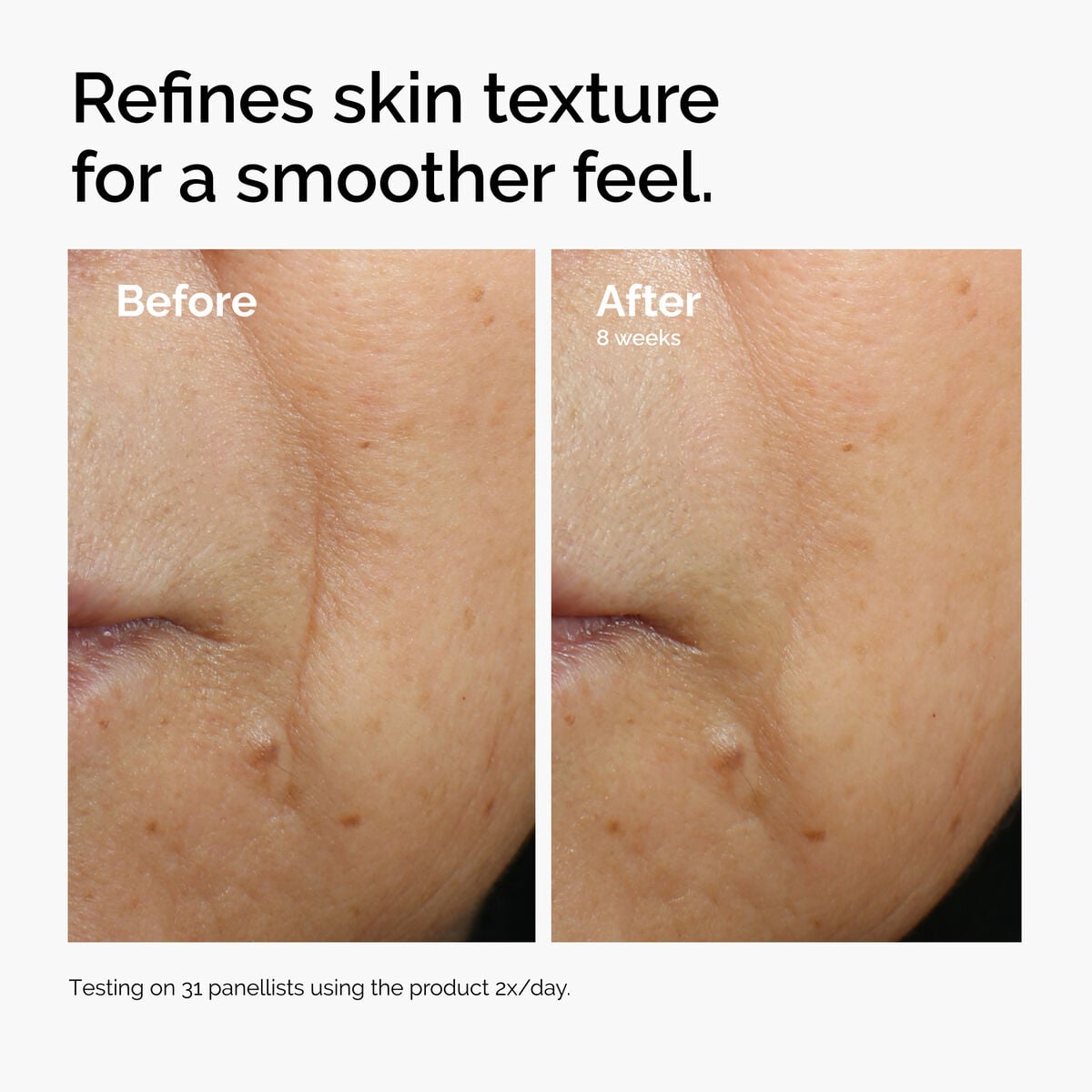 caffeine-3-escin-1-face-serum-k1 ord-caffeine-3pct-escin-1pct-face-serum-before-after-texture.jpg