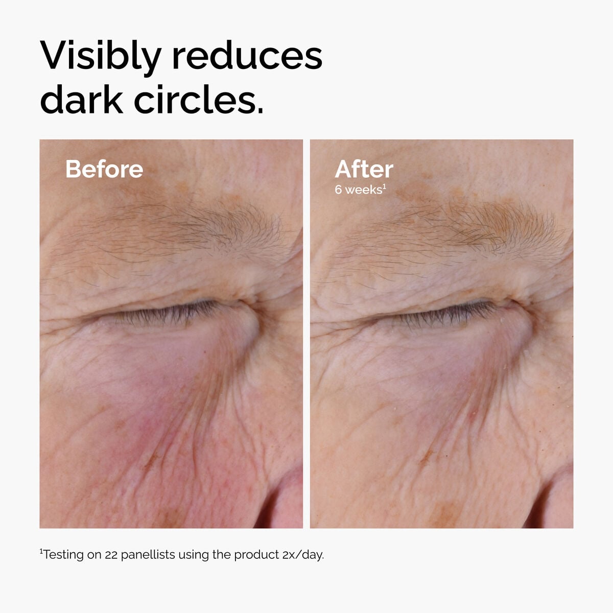 caffeine-solution-5-egcg-eye-serum-t2 ord-caffeine-solution-egcg-dark-circles-before-after.jpg