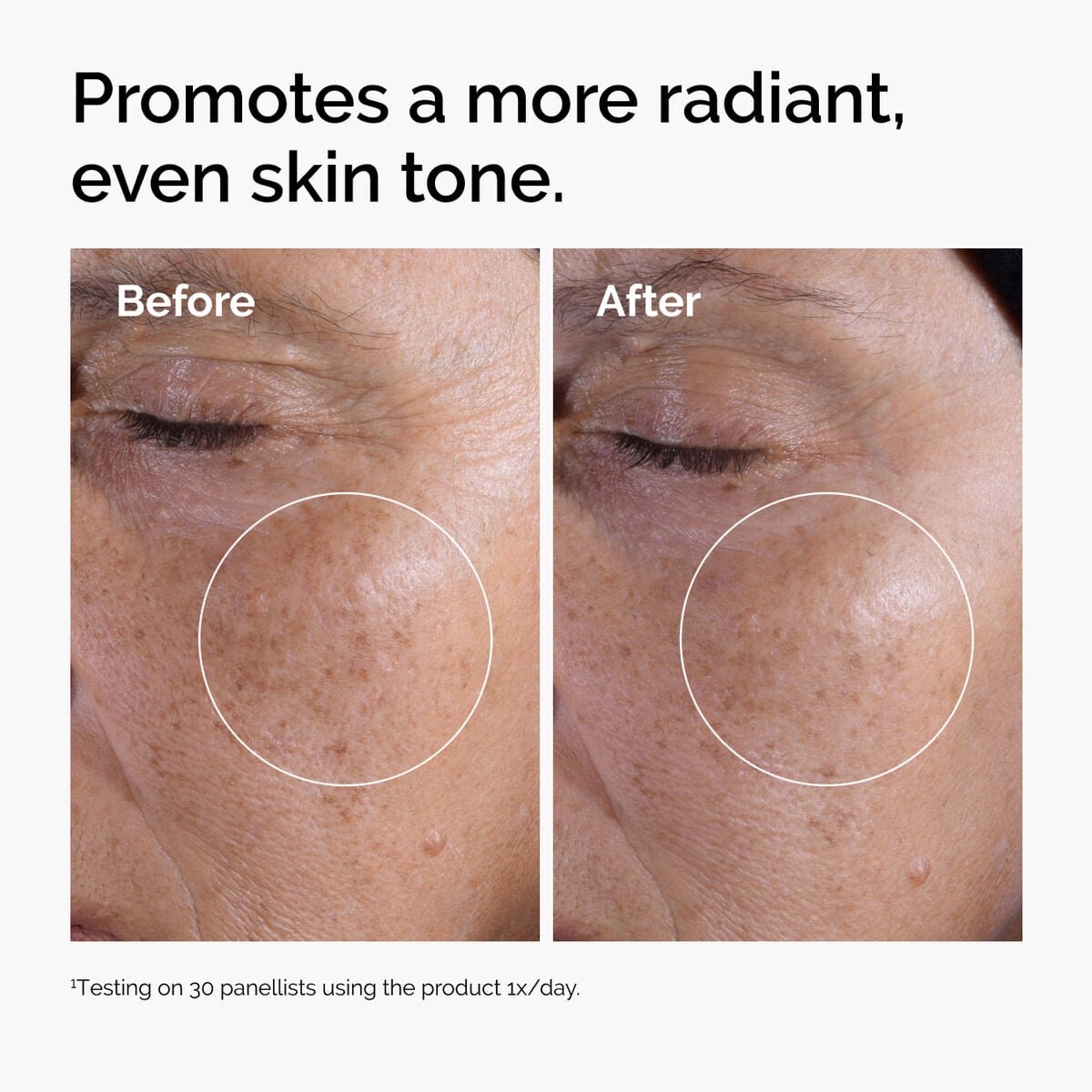 glycolic-acid-7-exfoliating-toner-c4 ord-glycolic-before-after-radiance.jpg