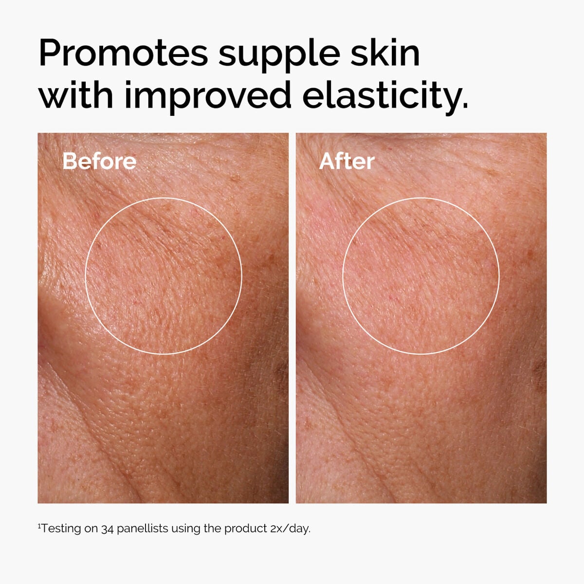 hyaluronic-acid-2-b5-with-ceramides-p5 ord-hyaluronic-acid-2pct-b5-hydrating-serum-before-after-elasticity.jpg