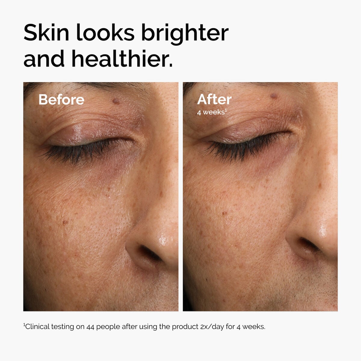 multi-antioxidant-radiance-serum-v0 ord-mars-before-after-healthy.jpg