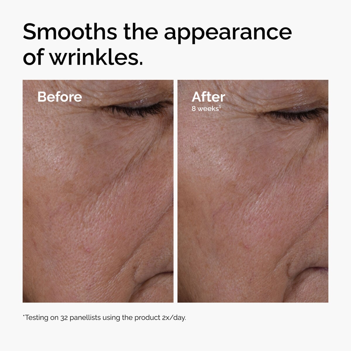 multi-peptide-ha-serum-h5 ord-multi-peptide-ha-serum-wrinkles-before-after.jpg