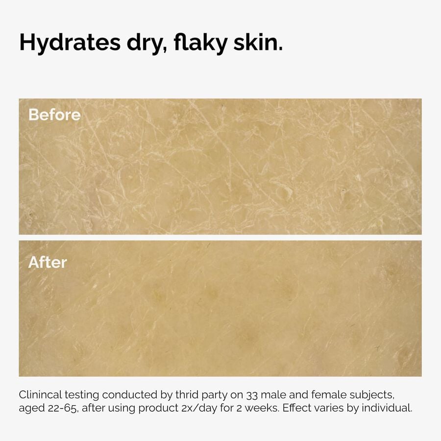 the-body-care-collection-c4 ord-natural-moisturizing-factors-inulin-body-before-after-graphic-02.jpg