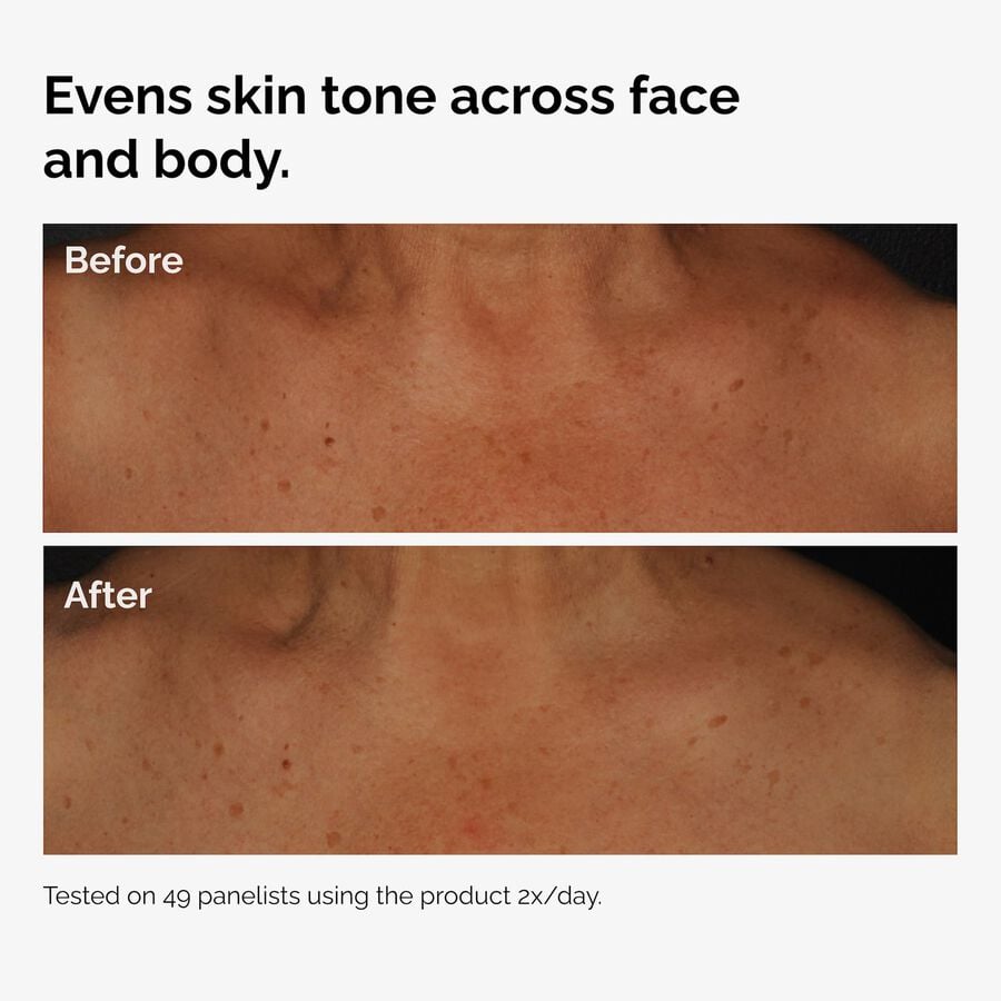 the-body-care-collection-c4 ord-niacinamide-face-body-serum-before-after-even-tone-graphic.jpg