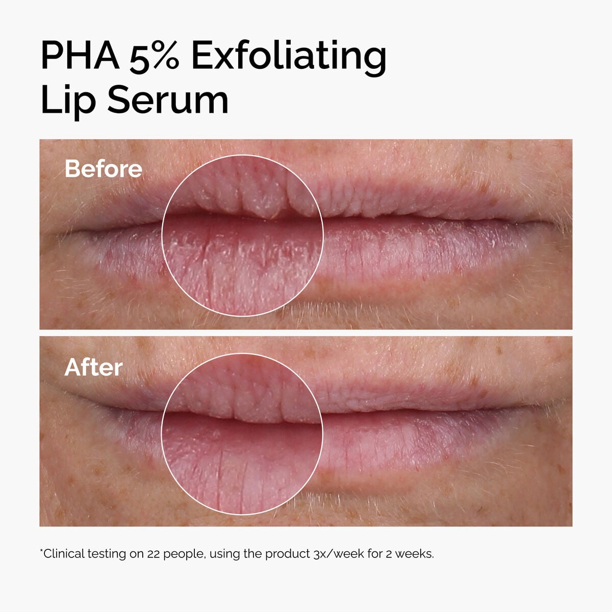 pha-5-exfoliating-lip-serum-f2 ord-pha-5pct-lip-exfoliating-serum-before-after.jpg