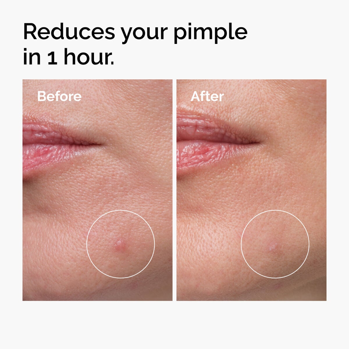 sulfur-10-powder-to-cream-concentrate-c1 ord-sulfur-10pct-powder-to-cream-concentrate-before-after-NA.jpg